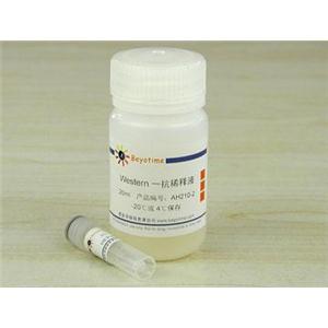 HER2/ErbB2抗体(兔多抗)