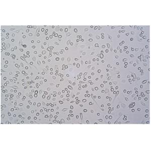 大鼠骨髓内皮祖细胞（EPC）