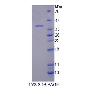 214kDa核孔蛋白(NUP214)重组蛋白