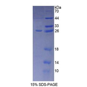 23kDa突触关联蛋白(SNAP23)重组蛋白