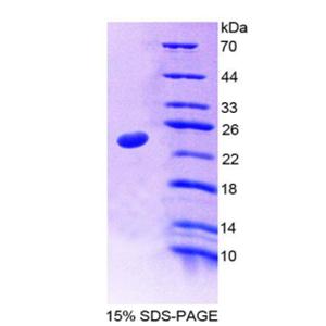 35kDa核孔蛋白(NUP35)重组蛋白