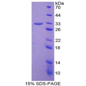 37kDa核孔蛋白(NUP37)重组蛋白