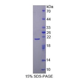 40kDa热休克蛋白2(HSPF2)重组蛋白