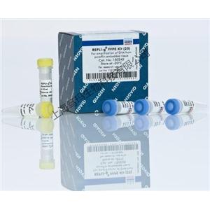 artus EBV TM PCR Kit (24) RUO