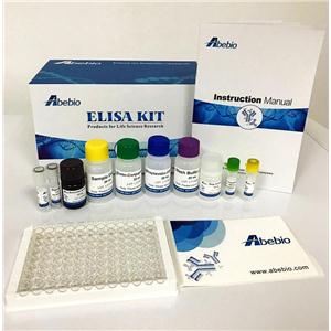 Human Carbohydrate antigen 199 (CA199) ELISA Kit