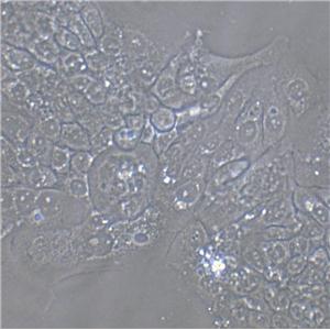 HT-29 Cell:人结肠癌细胞系