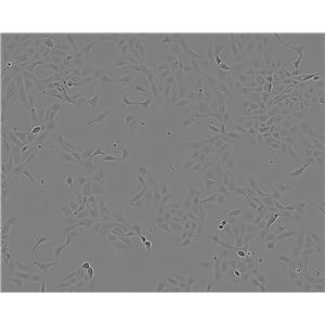 HeLa Cell:人宫颈癌细胞系