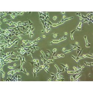 ETCC007 Cell:人乳腺导管癌细胞系