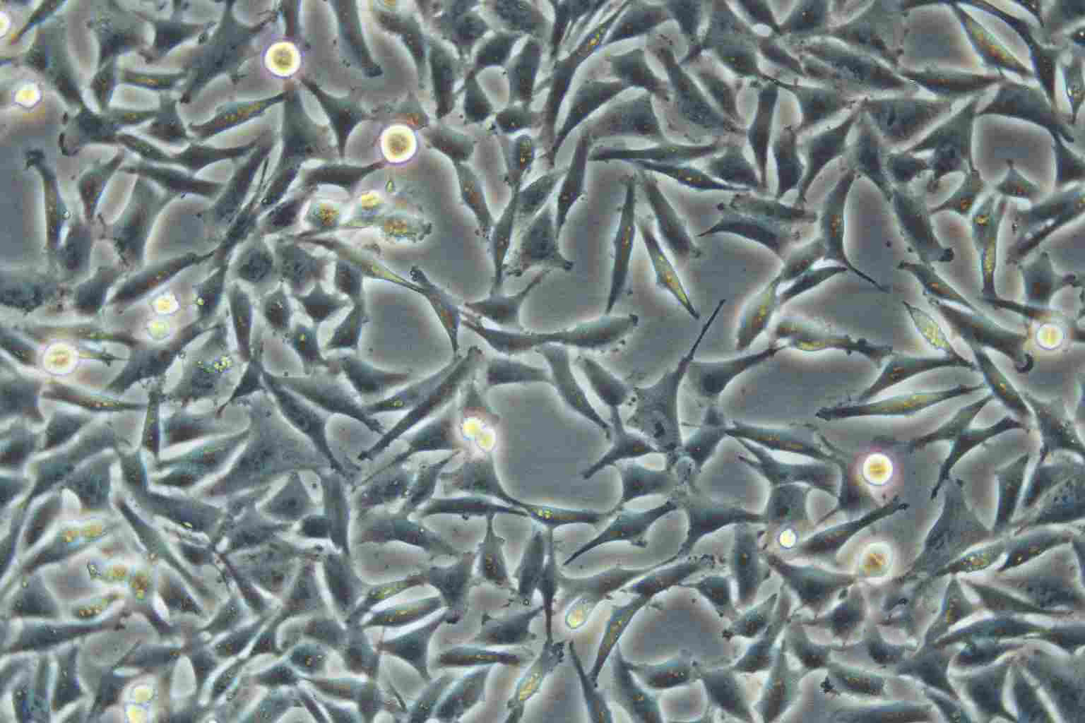 图16～8 黑素细胞产生黑色素示意图-功能组织学与胚胎学-医学