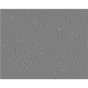 COLO 829 Cell:人黑色素瘤细胞系