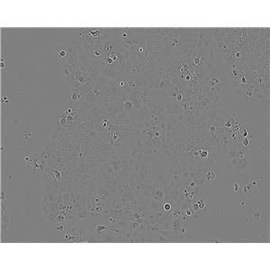 NCTC 1469 Cell:小鼠正常肝细胞系