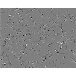 hTERT-RPE1 Adherent人视网膜色素上皮细胞系