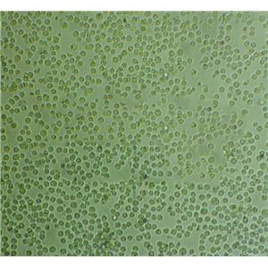 MOLT-16 Thawing人T淋巴细胞系