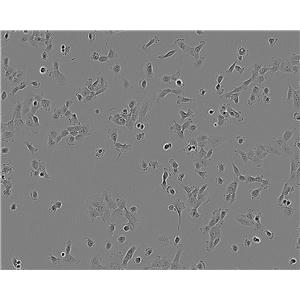 HO-8910 人卵巢癌细胞系