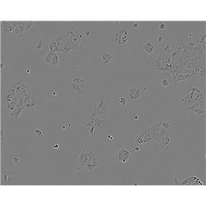 WPMY-1 人正常前列腺基质永生化细胞系