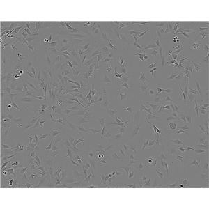 NH-6 人肾上腺神经母细胞瘤细胞系