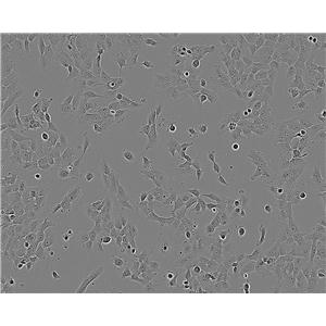 A-875细胞：人黑色素瘤细胞系