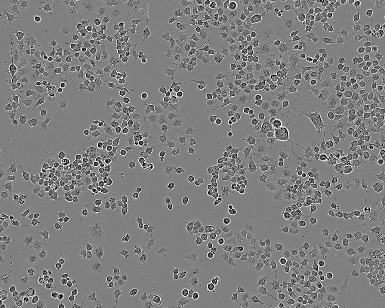 MCF-7细胞:人乳腺癌细胞系