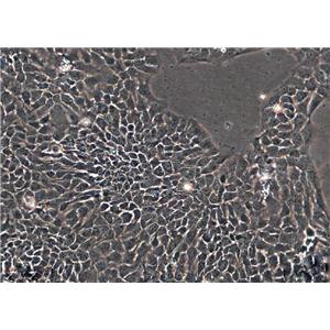 SCC-9细胞：人类鳞状上皮舌癌细胞系