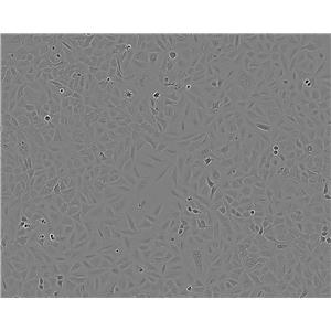 AsPC-1细胞：人胰腺癌细胞系