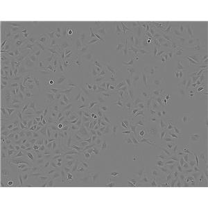 NCI-H1944细胞：人非小细胞肺癌细胞系