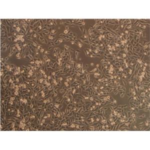 OVCAR-3细胞：人卵巢腺癌细胞系