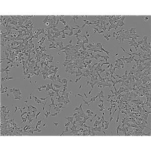 HT22细胞：小鼠海马神经元细胞系