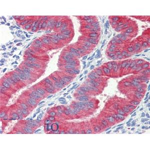 兔抗马多克隆抗体