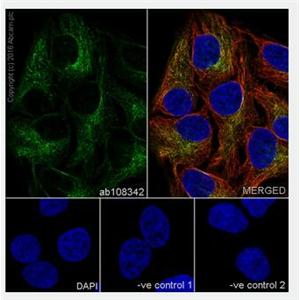 ANTI-BETA I TUBULIN抗体