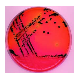 伊红美蓝培养基（EMB）