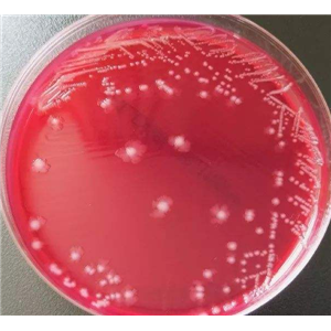 乳糖发酵培养基