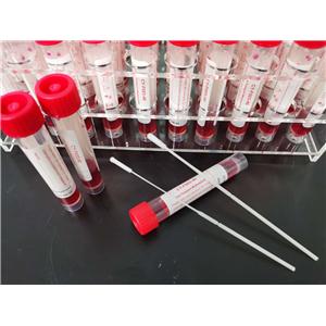 一次性使用病毒采样管