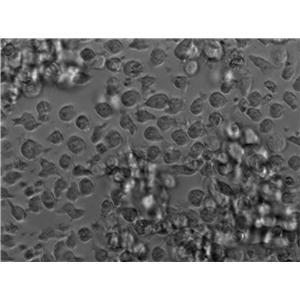 Namalwa Cell|人Burkitt＇s淋巴瘤细胞