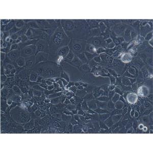 SK-MES-1 Cells|人肺鳞癌克隆细胞(包送STR鉴定报告)