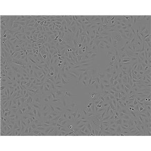 ATDC-5:小鼠胚胎瘤复苏细胞(提供STR鉴定图谱)