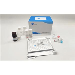 人前列腺癌细胞