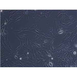 MCA-205小鼠纤维肉瘤复苏细胞(附STR鉴定报告)