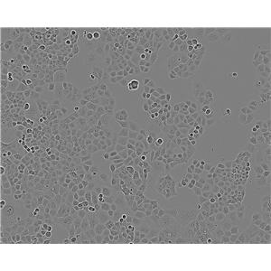 KGN人卵巢颗粒复苏细胞(附STR鉴定报告)