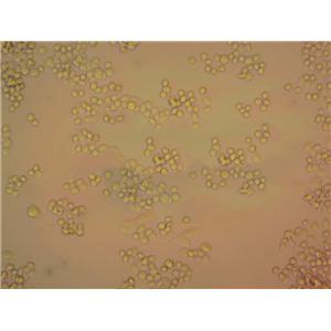 滤膜肠球菌琼脂粉末状态培养基
