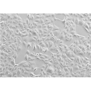 S-180淋巴母细胞小鼠肛门肉瘤细胞