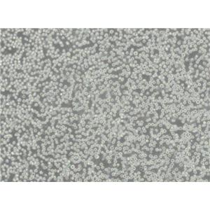 NCI-H719人小细胞肺癌细胞