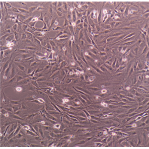 S180小鼠艾氏腹水瘤细胞