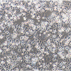 HMC人肾小球系膜细胞