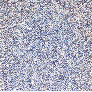 KCL-22人慢性髓样白血病细胞