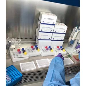 人抗球蛋白(AG)Elisa试剂盒