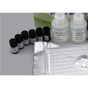 人细胞角蛋白21-1片段(CYFRA21-1)Elisa试剂盒