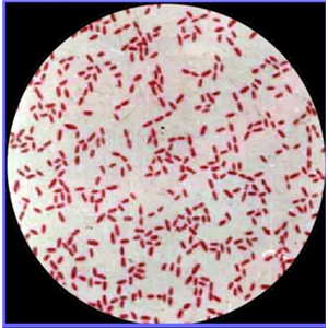 革兰染色大肠埃希菌图片