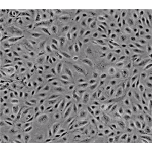 永生化人视网膜微血管内皮细胞