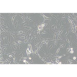 A172（人胶质母细胞瘤细胞） (STR鉴定正确)