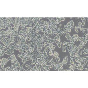 RL95-2（人子宫内膜癌细胞）